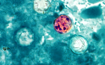 Cyclosporiasis